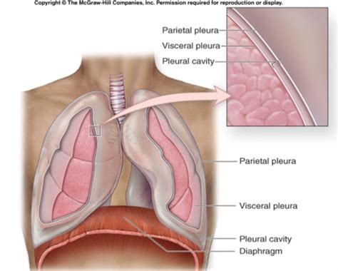 Pneumothorax Flashcards Quizlet