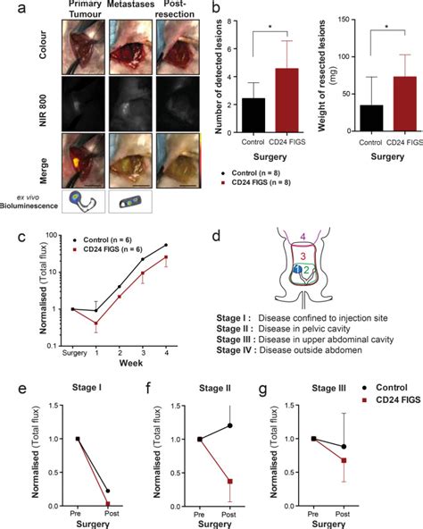 CD24 Targeted Intraoperative Fluorescence Image Guided Surgery Leads To