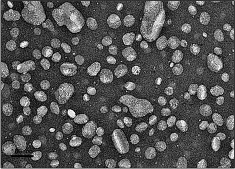 Transmission Electron Microscopy TEM Image Of Nanostructured Lipid