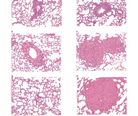 Time Course Of EMT 6 Tumour Treatment In BALB C Lung BALB C Bd