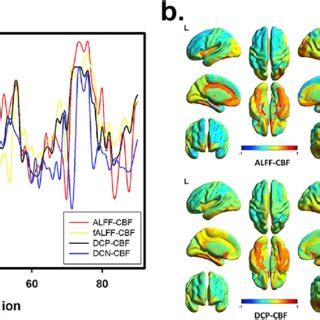 Significant Differences Of Brain Region Based Neurovascular Coupling