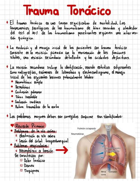 Trauma Torácico Valentina Lopez Udocz