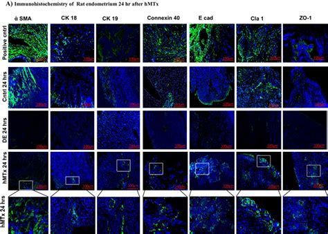 A Immunohistochemical Expressions Of Sma Ck Ck Cx E