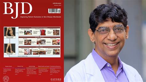 Kerala Doctor Wins Global Acclaim As British Journal Of Dermatology