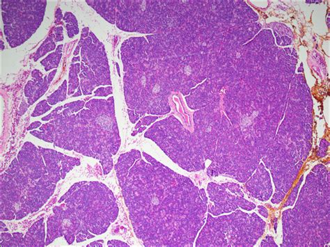 Pancreas Normal Histology Nus Pathweb Nus Pathweb