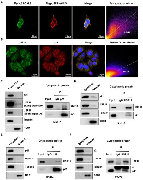 Cytoplasmic p21 interacts with USP11. (A) Myc-p21-ΔNLS or... | Download ...