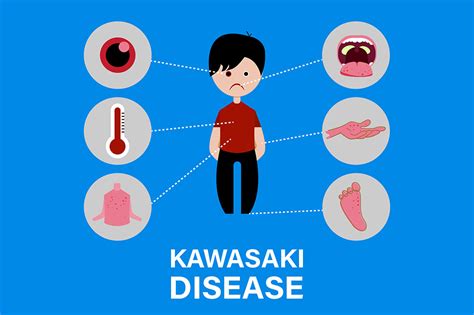 Kawasaki Disease Causes And Symptoms