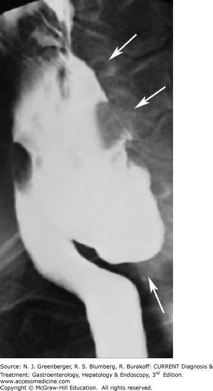 State Of The Art Imaging Of The Gastrointestinal System Abdominal Key