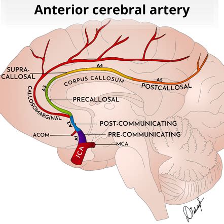 Anterior Cerebral Artery Stroke