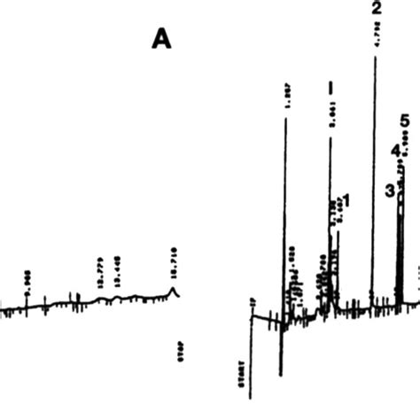 Representative Gc Npd Chromatograms • Blank Human Whole Blood A And