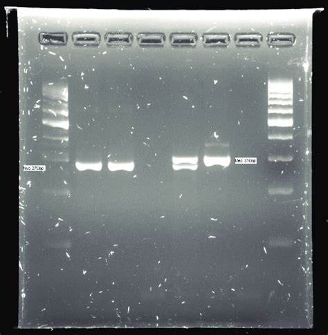 Reacci N En Cadena De Polimerasa Multiplex Gen Mec Nuc Electroforesis