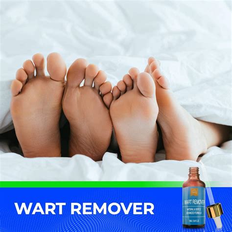 Wart Remover Liquid | Rapidly Eliminates Plantar & Common Warts