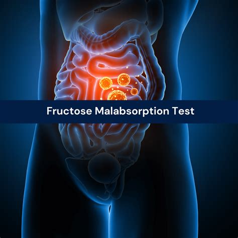 Fructose Malabsorption Test - Christine Barnes | Complex Case