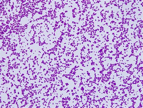 Staphylococcus Epidermidis Gram Stain