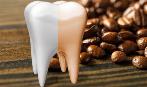 10 Foods And Beverages That Can Stain Your Teeth