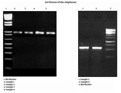 Agarose Gel Electrophoresis Download Scientific Diagram