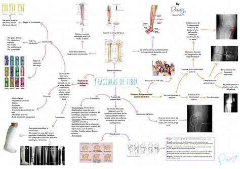 Traumatología y Ortopedia uDocz