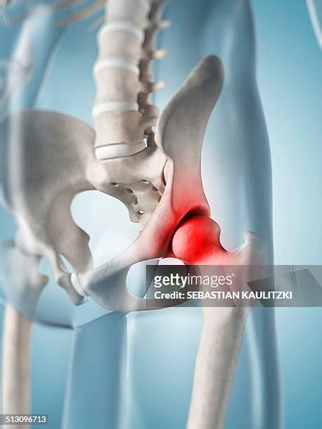 Hip Pain Anatomy Photos and Premium High Res Pictures - Getty Images