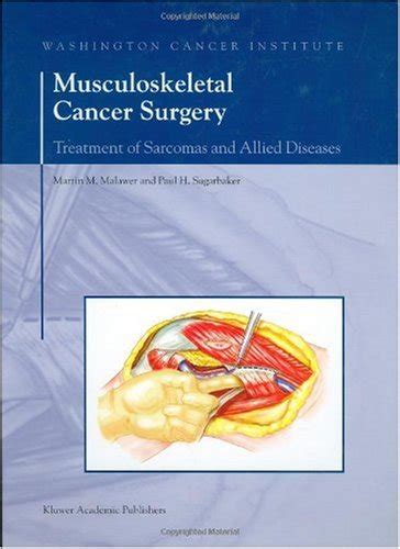 Musculoskeletal Cancer Surgery Treatment of Sarcomas and 読書メーター