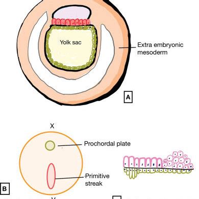 Stages of secondary neurulation beginning just as the posterior ...