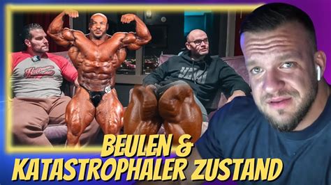 Stefan Kienzl über Big Ramy s katastrophale Synthol Form William