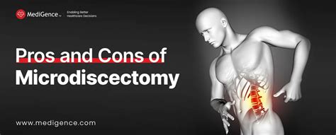 Microdiscectomy Pros And Cons