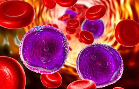 Study Shows Acute Myeloid Leukaemia S Epigenetic Susceptibility ET