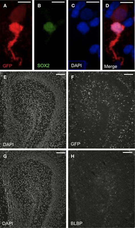 Frontiers Transcription Mapping Of Embryonic Rat Brain Reveals Egr