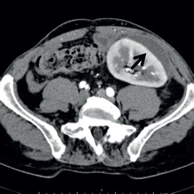 Contrast-enhanced computerized tomography (CT) scans of the... | Download Scientific Diagram