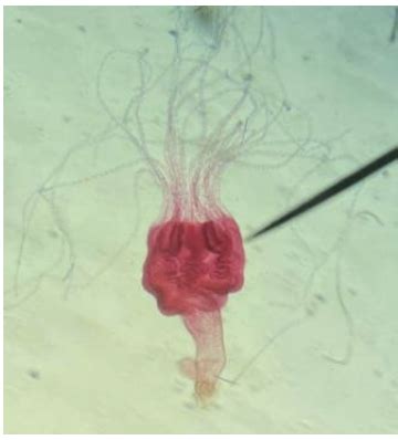 Phylum Cnidaria Flashcards | Quizlet