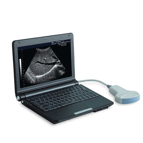 Portable Medical Vet Ultrasound Scanner Sonoscape Ultrasonido Portatil