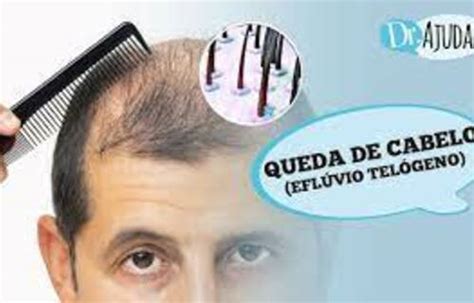 Queda De Cabelo Entenda As Causas E Tratamentos Do Efl Vio Tel Geno