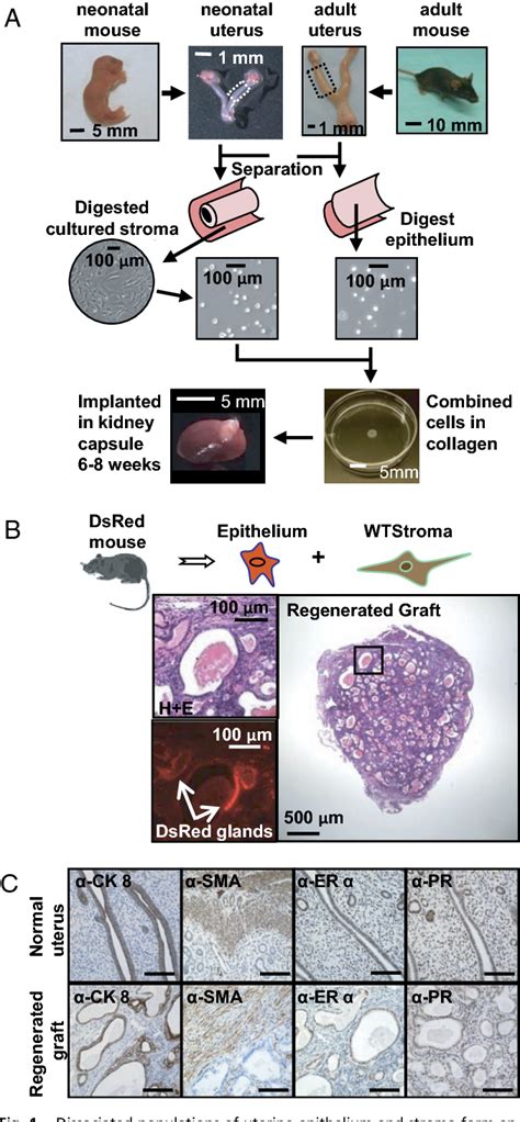 Figure 1 From Cell Autonomous Activation Of The Pi3 Kinase Pathway Initiates Endometrial Cancer