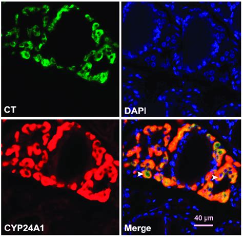 Double Immunofluorescence Demonstrating Colocalization Of Cyp24a1 And Download Scientific