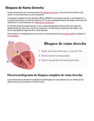 Bloqueo Incompleto de Rama Derecha Criterios electrocardiográficos