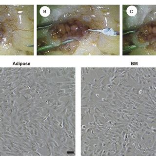 Characterization Of Adipose Derived Mesenchymal Stem Cells A MSCs And