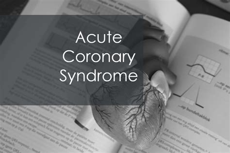 Acute coronary syndrome | Symptoms, Types and Treatment | Medcrine