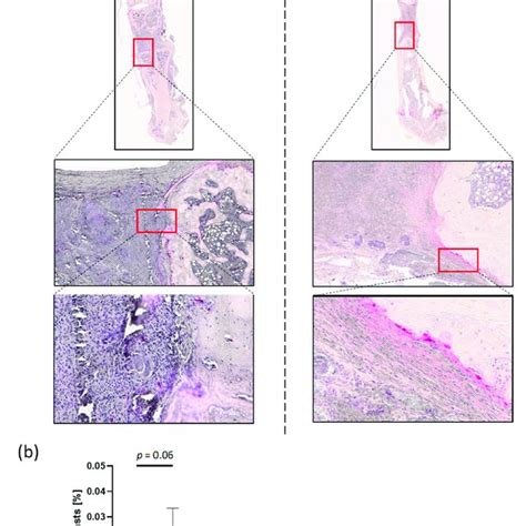 TRAP Staining Shows Invasion Of Osteoclasts In HACaS G A TRAP