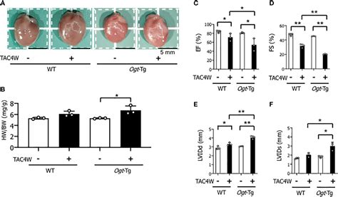 Frontiers O Glcnacylation Induced Gsk 3β Activation Deteriorates