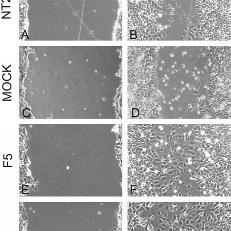 Effect Of SOX2 Overexpression On Cell Wound Recovery Nearly Confluent