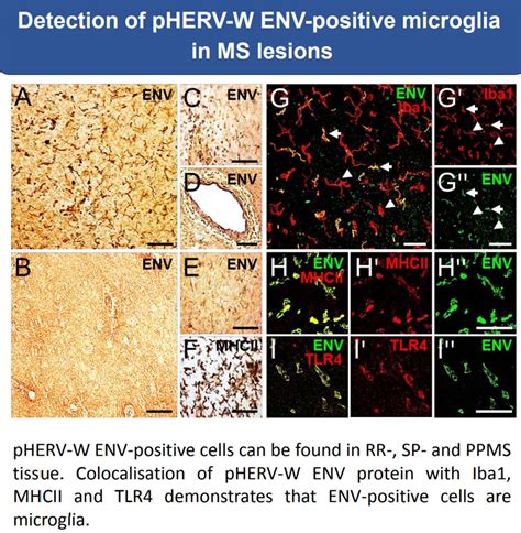 The human endogenous retrovirus type W (pHERV-W) was found to be a ...