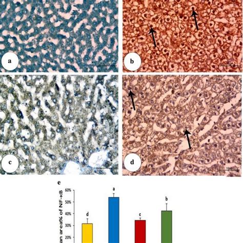 Photomicrographs Of Sections In The Liver Illustrating A Control Group