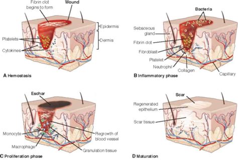 Exam Assessment Of Integumentary And Wounds Flashcards Quizlet