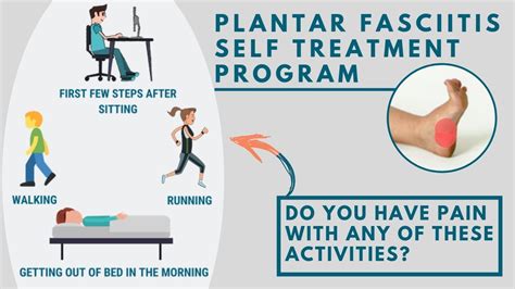 Plantar Fasciitis Self Treatment Program Overview Youtube