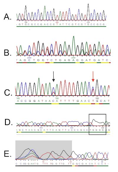 16s Rrna Sequencing Identifying Bacterial Species By Pcr