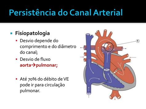 Escola Superior de Ciências da Saúde SES DF ppt carregar