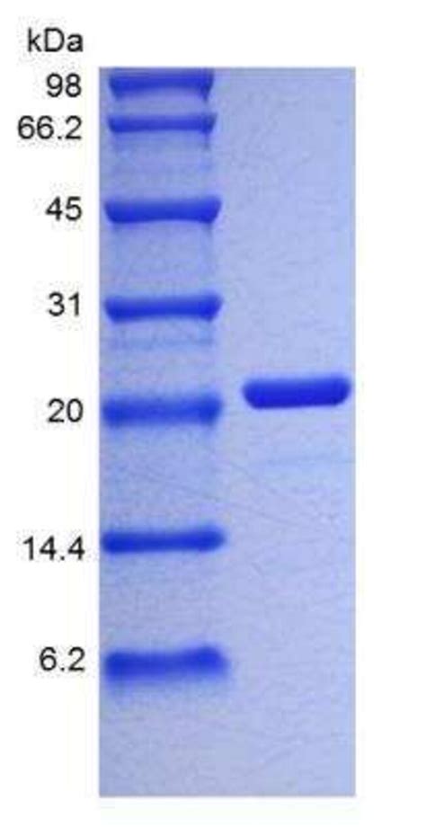 Novus Biologicals Recombinant Human Il Protein Mg Fisher Scientific