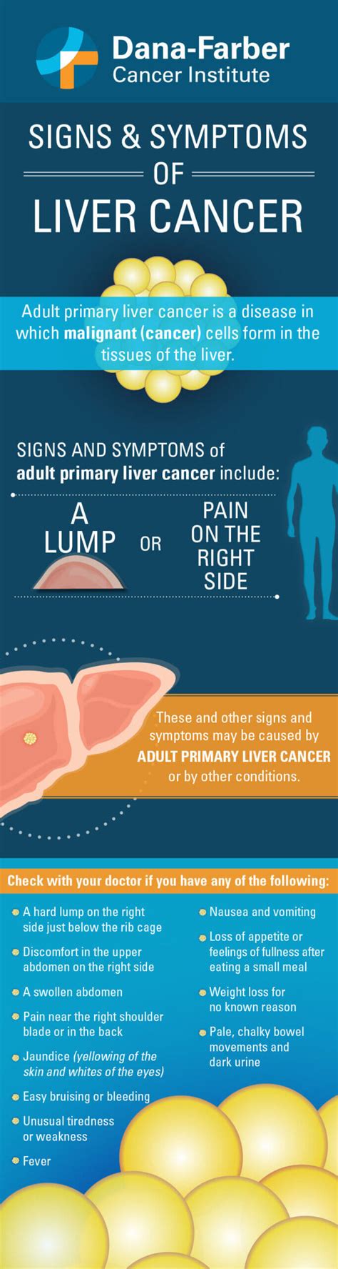 Signs And Symptoms Of Liver Cancer Infographic Dana Farber Cancer Institute