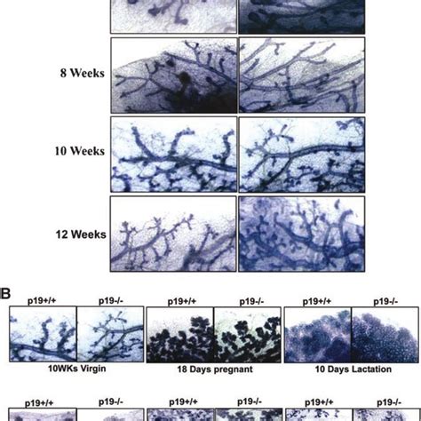 Morphogenesis Of Wt And P Arf Null Mammary Glands During Development