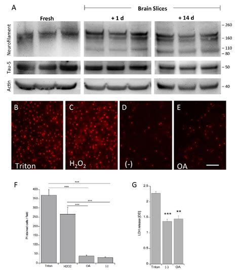 Figure From Differential Hyperphosphorylation Of Tau S T And